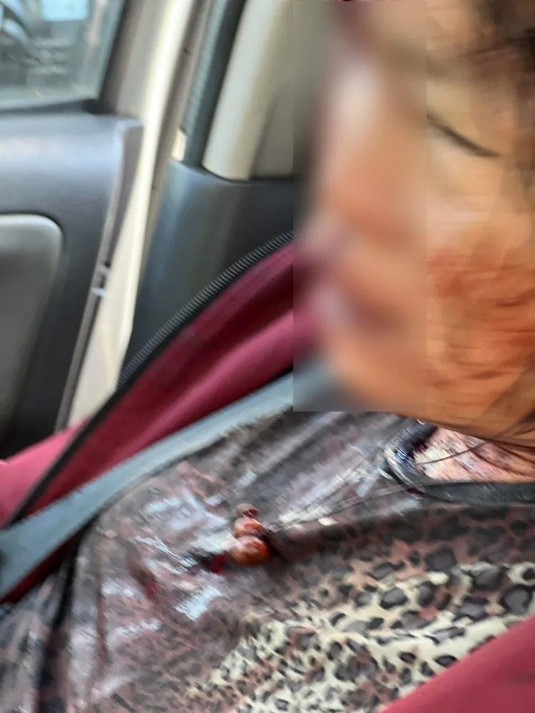 陳姓婦人指稱，在沙鹿區斗潭路住處後方整理回收物時遭攻擊。楊婦提供