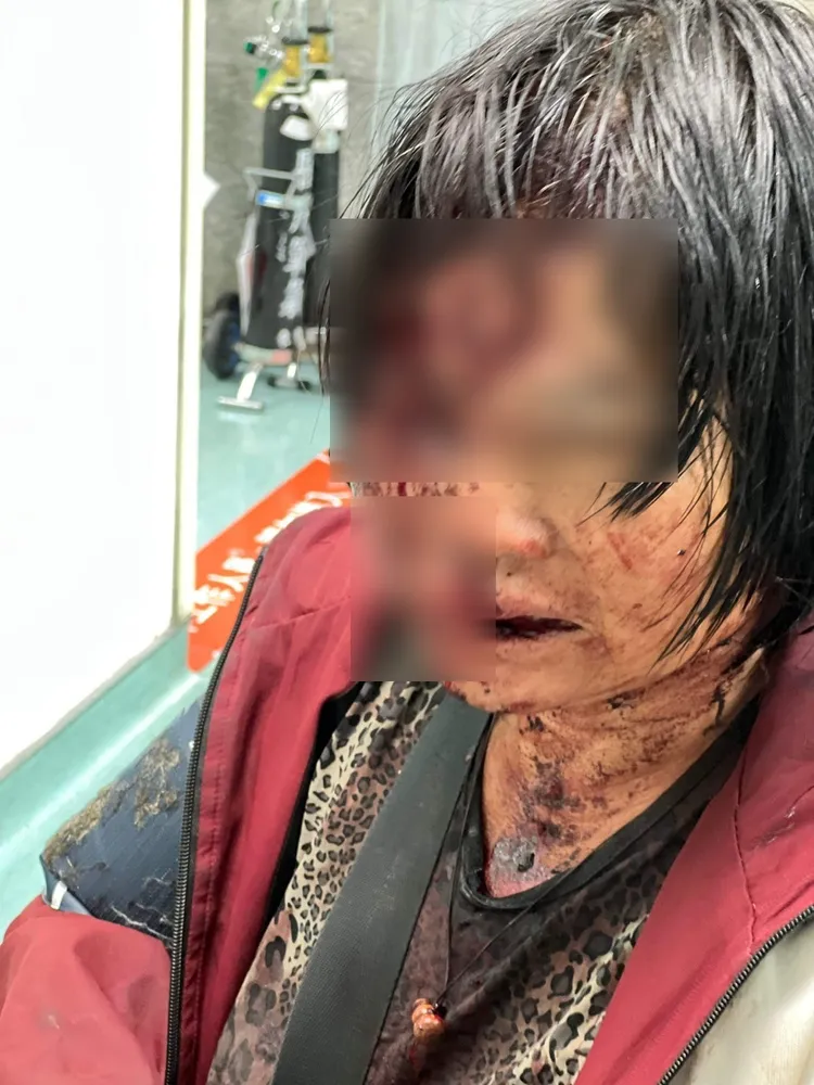 陳姓婦人控訴對方先朝她噴辣椒水、再以棍棒毆打。楊婦提供