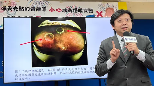 雷射筆害瞎眼!醫:打1發視力1.0掉到0.1 消基會揪網拍一堆違法全下架