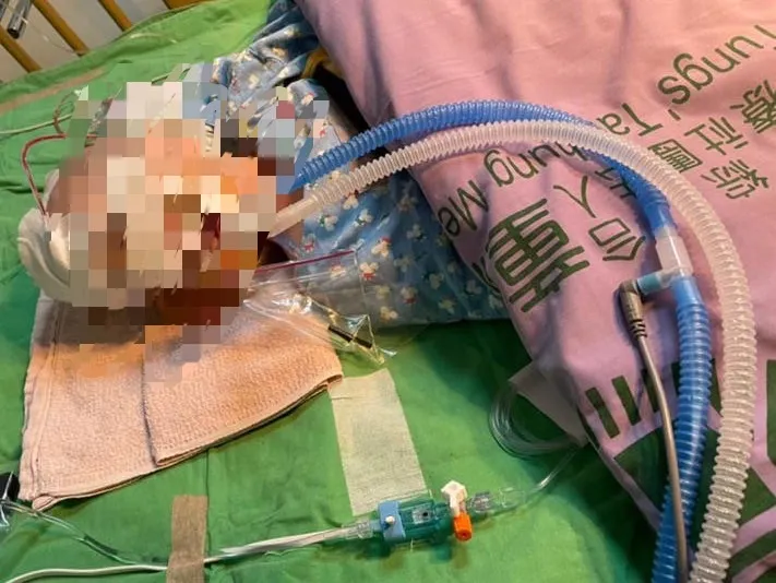 一歲女童「小桃子」疑遭保母虐待重傷致死。家屬提供