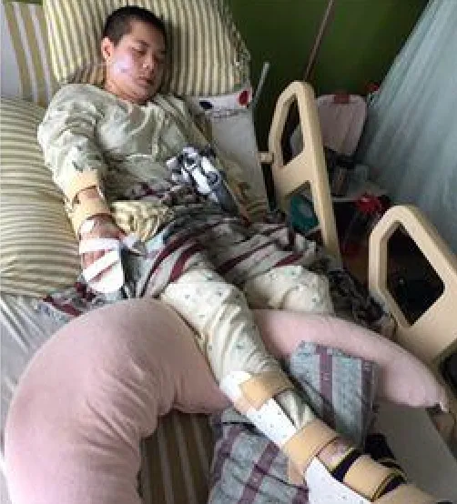 楊姓正妹被警車撞傷智力受損。家屬提供