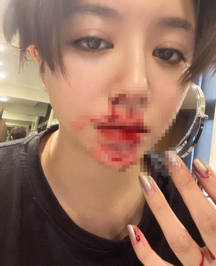 李妍瑾滿臉鮮血畫面超驚悚。翻攝自李妍瑾臉書