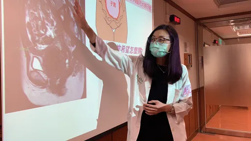 52歲婦未孕卻挺6月肚 達文西手術助她告別大肚腩