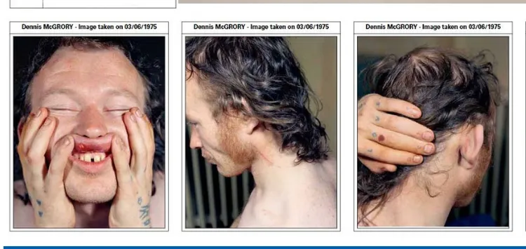 嫌犯麥戈瑞1975年被捕時身上的新傷。圖片來源／英國皇家檢控署（CPS）官網