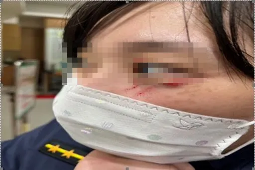 新北醉男返家毆妻打子 離譜!不僅抓傷女警臉還猛踹男警頭