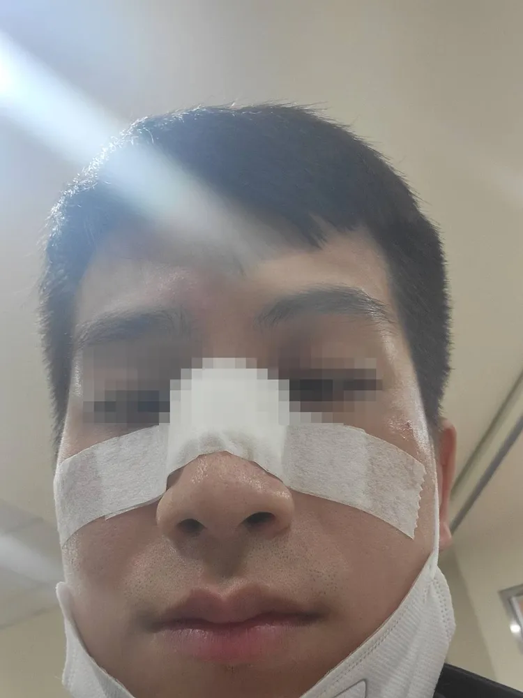 游男在醫院趁鬆開腳部鬆緊帶時，竟踹傷戒護就醫的警員張逸軒。民眾提供