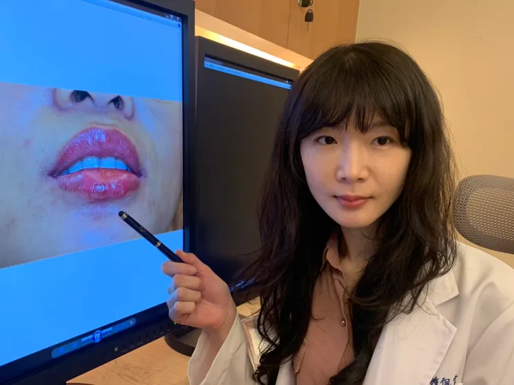 茂盛醫院皮膚科主任鍾佩宜最近收治一名因紋唇導致感染泡疹病毒的個案。曾雪蒨攝