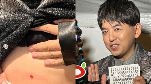 新北耶誕城尾聲出意外!黃子佼肚皮見血親揭傷勢