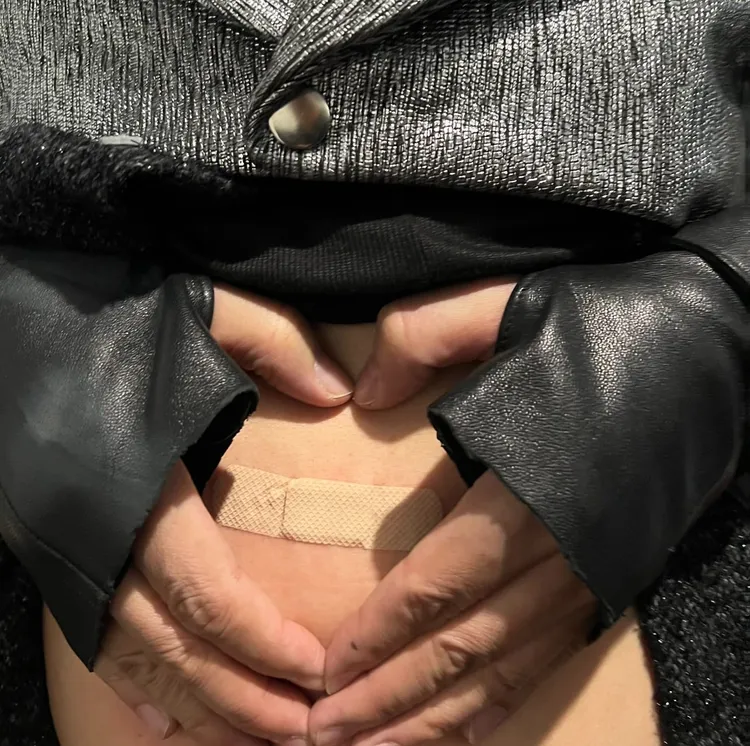 收工趕緊處理傷口。黃子佼提供