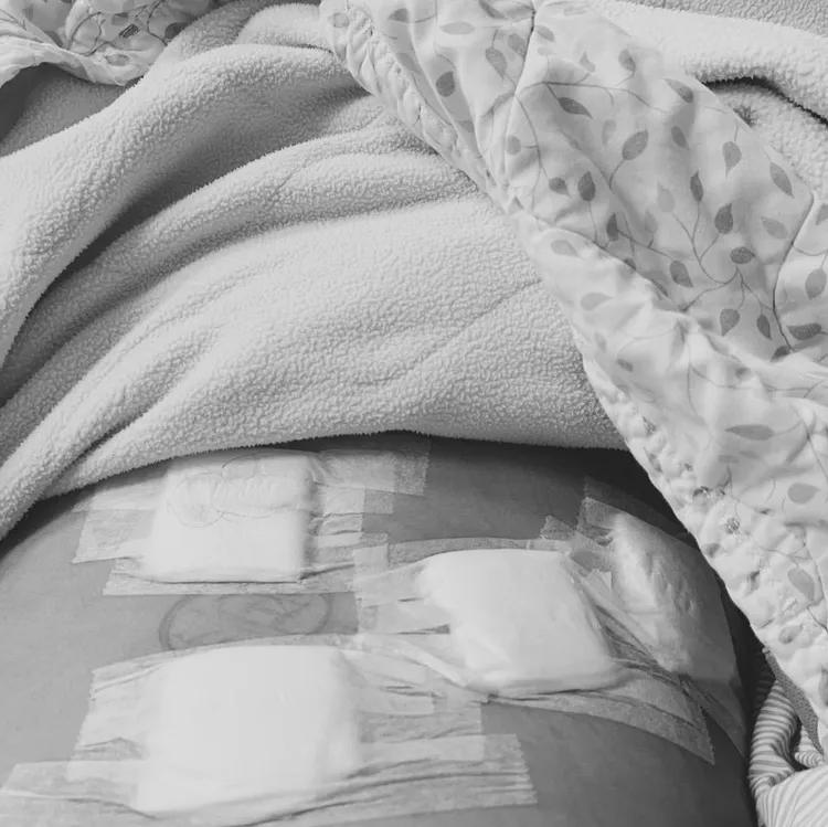 潘逸安昨動刀切除十二指腸腫瘤。翻攝潘逸安臉書