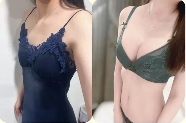 原PO隆乳後，相當滿意自己的決定。引自Dcard