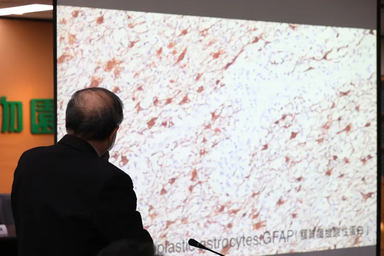 團團左腦有明顯萎縮。鄭孟晃攝