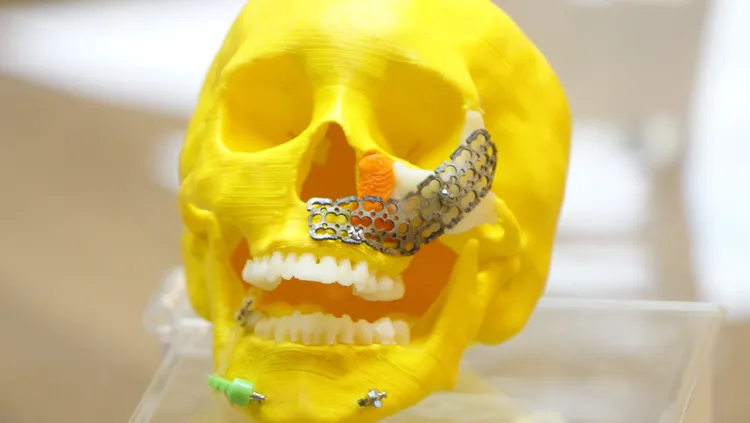 3D列印製作的頭骨模型與骨板等。莊宗達攝
