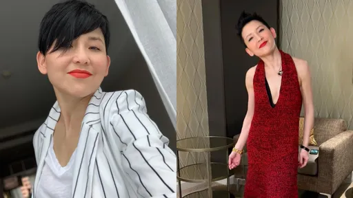 金馬影后驚見直徑5公分鬼剃頭 崩潰曬出「有天可能變光頭」