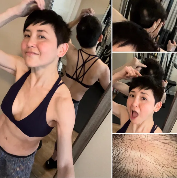 劉美君大方分享鬼剃頭照片。翻攝劉美君IG