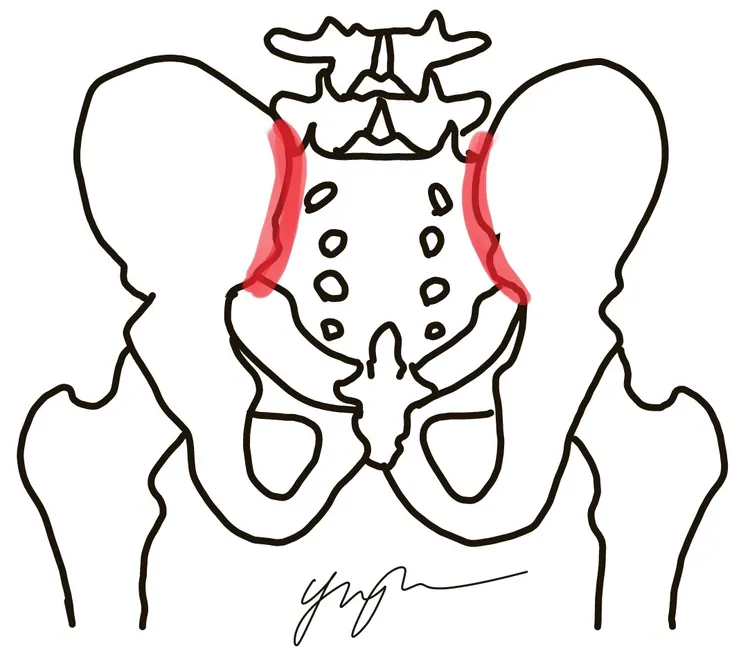紅色處即為薦髂關節。奇美醫院提供