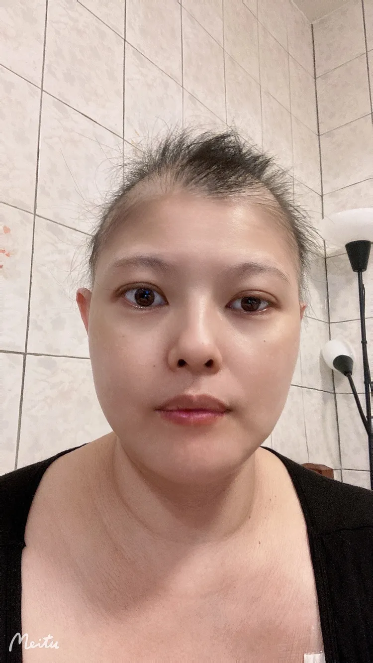 顏伶安初接受化療期間，因藥物副作用掉頭髮。顏伶安提供