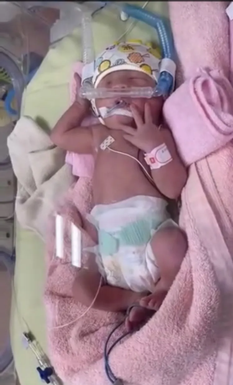 今年三月懷孕32周的顏伶安提早破水，產下1920公克的女兒。顏伶安提供