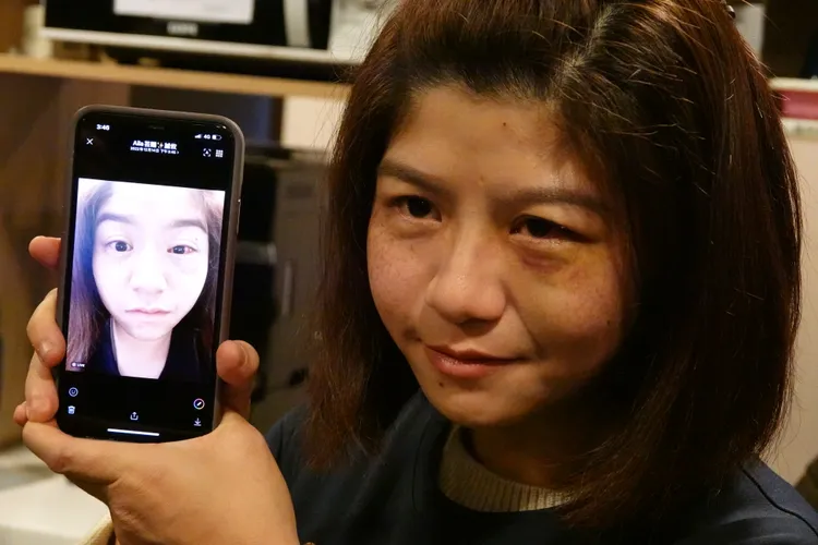 宋女出示當天的傷勢，強調不是被打傷。陳德興攝