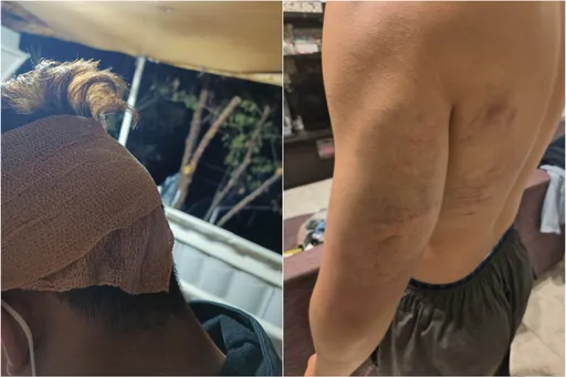 獨家|原民狩獵遭鋁棒狂扁!登山協作奪槍抵頭 嗆:這我的營業場所