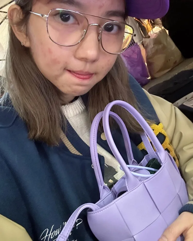 林玉書臉部多處紅腫。翻攝自林玉書IG