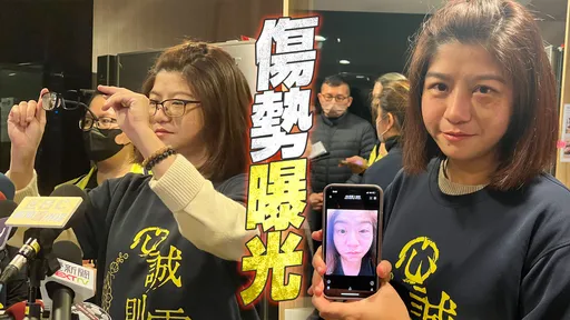 太玄宮女信徒左眼瘀青、眼鏡斷了！　兩樣證據記者會現場曝光