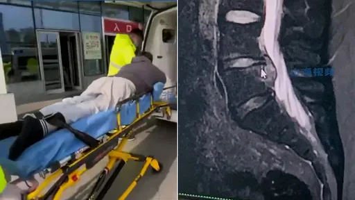 教7歲女兒寫功課「氣到摔斷尾椎骨」　爸爸拒出院：不想再教了