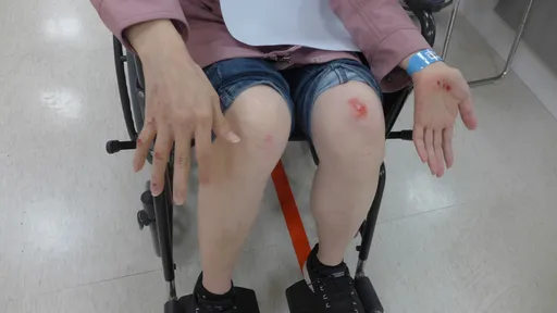 婦人搭公車慘遭閉門羹 物品遭車門夾還慘被拖行