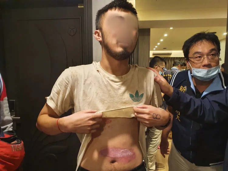 被害人身上遭毆出多處傷痕。翻攝畫面