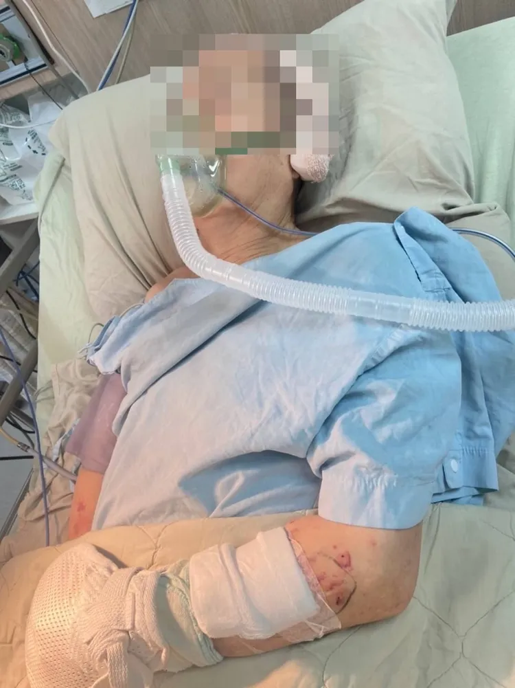 張姓老翁住院治療時情況危急，嘴巴還插著管。投訴人提供