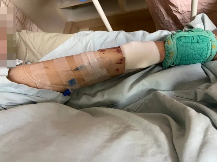 家屬看到老父親住院時忍著痛楚打針心都碎了。投訴人提供