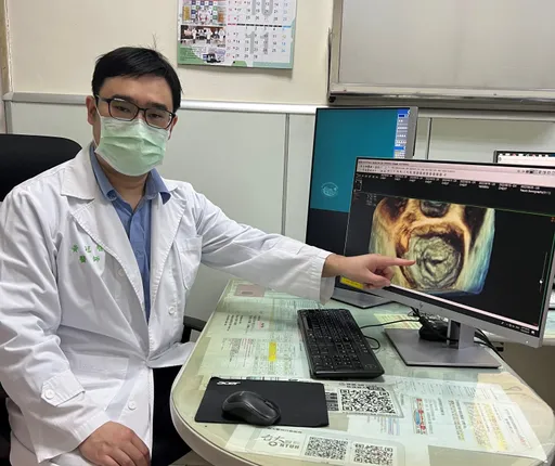 新竹女童心臟出問題!不用「提心」弔膽了 3D心臟超音波讓家屬「看懂病灶」