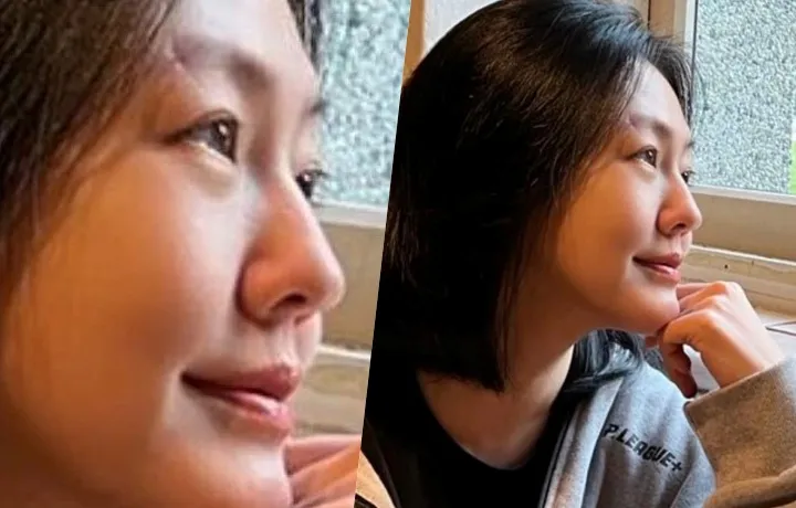 小S這張照片意外引起網友討論眉骨的疤痕。翻攝自小S臉書