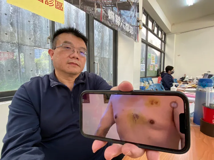 施勝桓醫師今天提及一名47歲好友因家族心血管疾病遺傳，10年內3度心肌梗塞，最後一次去年發作則是寒流中慢跑造成。曾雪蒨攝