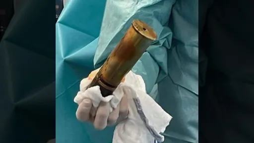 88歲阿伯「肛塞砲彈」求性快感 卡彈求醫!嚇到院方緊急疏散