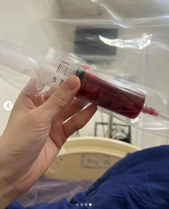 雪碧PO出針筒內填滿紅色液體的照片。翻攝雪碧IG