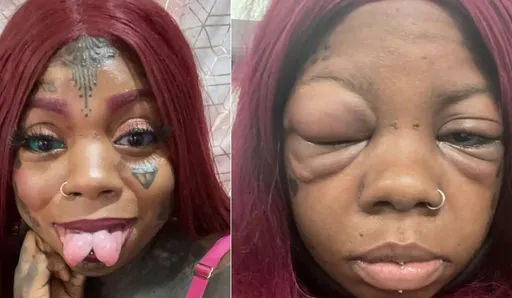 真瞎！辣媽眼球紋上顏色　現在真的快瞎了