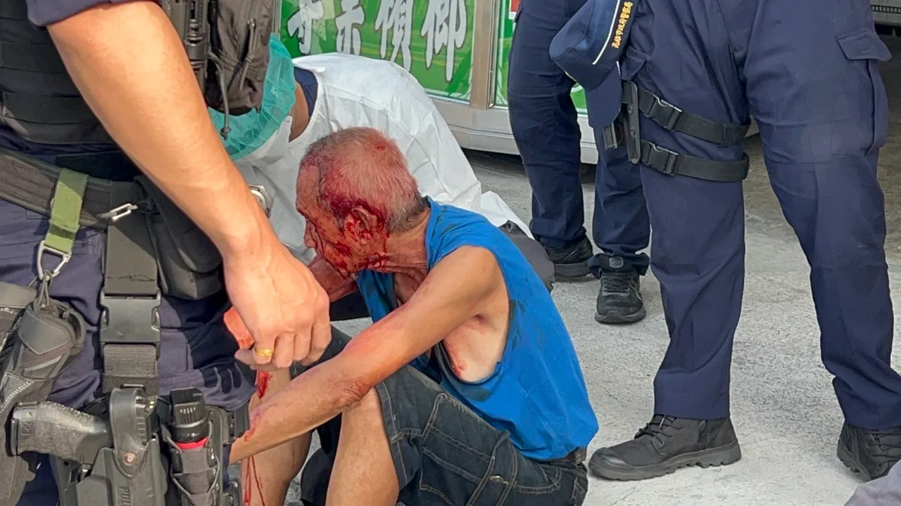 蔡姓男子被對方拿玻璃瓶攻擊,血流滿面。侯昌騰攝