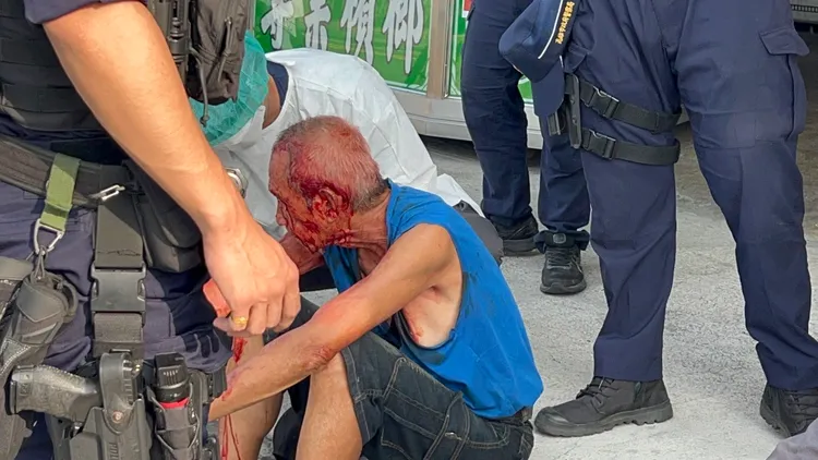 蔡姓男子被對方拿玻璃瓶攻擊，血流滿面。侯昌騰攝