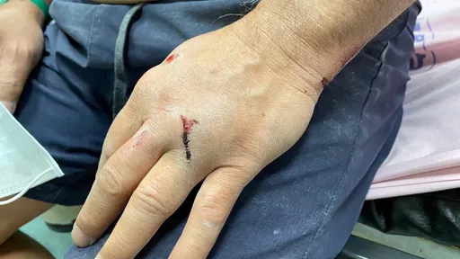 兇殘！貨車司機為停車持棍往車内狂刺　65歲翁胸挫傷