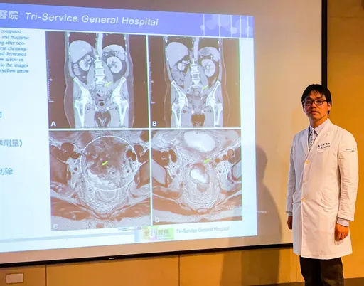 癌王找上門免驚! 三總「這技術」復發率降7%、5年存活率近6成