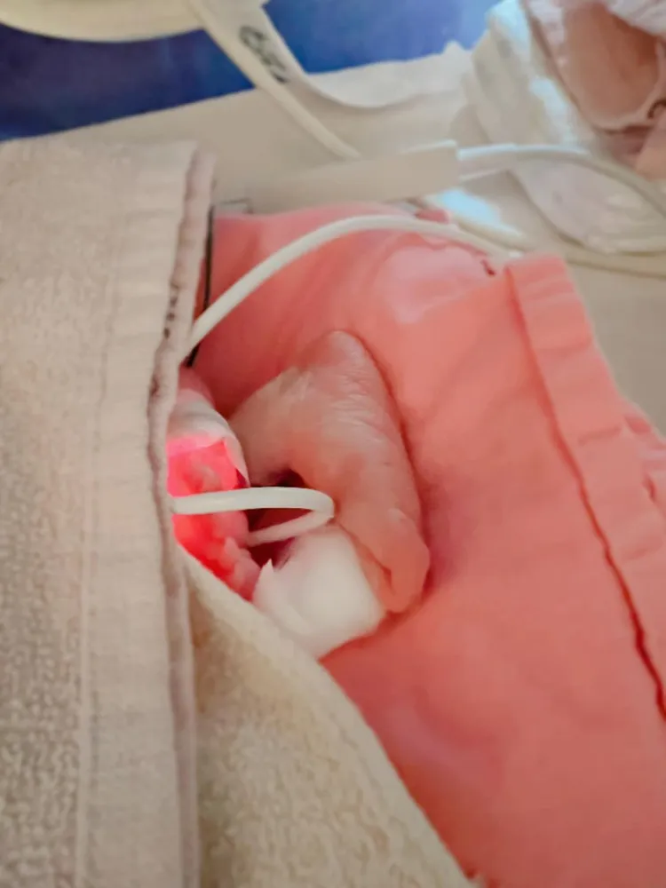 林宜融的孩子目前在保溫箱治療中。翻攝林宜融臉書