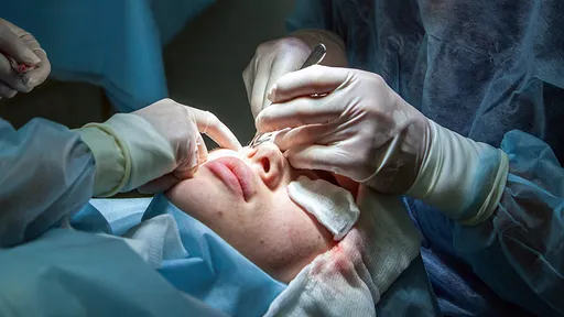 邊境解封立即衝南韓整容 20多歲女麻醉後「驟死手術檯」