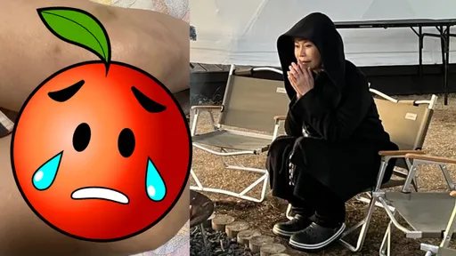 詹雅雯痛心被身邊人騙3千萬 想放鬆泡溫泉竟冒後遺症