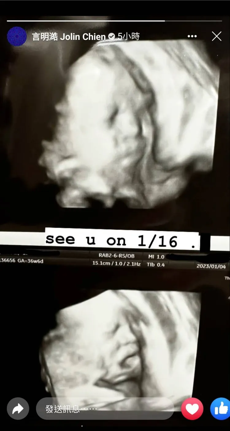 言明澔今分享限動，疑似是寶寶的超音波照片。翻攝言明澔臉書