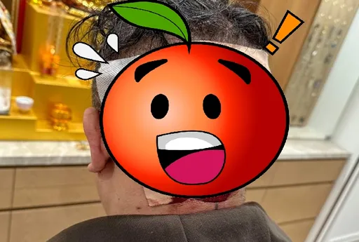 館長「後腦杓一大包還滲血」 粉絲心驚!原來他做了這件事