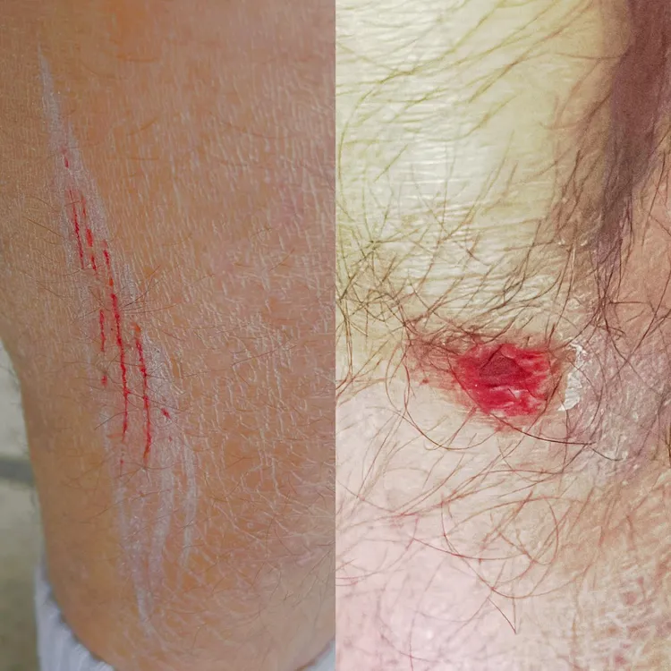 郭彥均騎車不慎腿部掛彩。翻攝郭彥均臉書