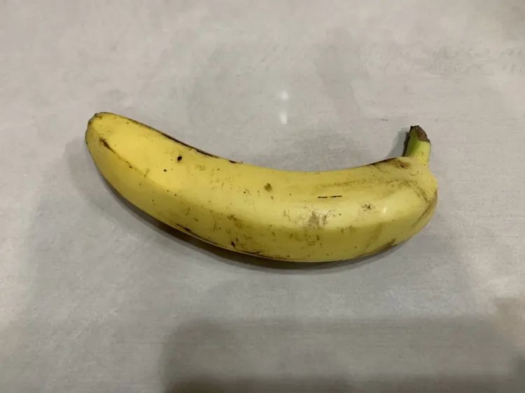 陰莖彎曲矯正手術需在陰莖上動刀，部分男性患者會因此卻步。侯昌騰攝