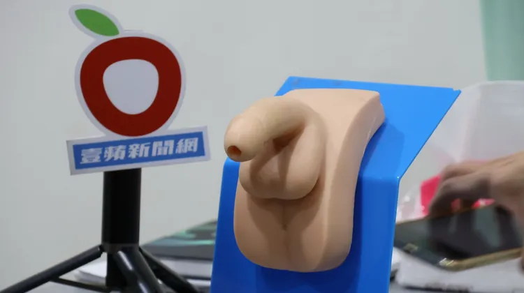 醫師指陰莖彎曲若不影響生活，無需就醫。侯昌騰攝