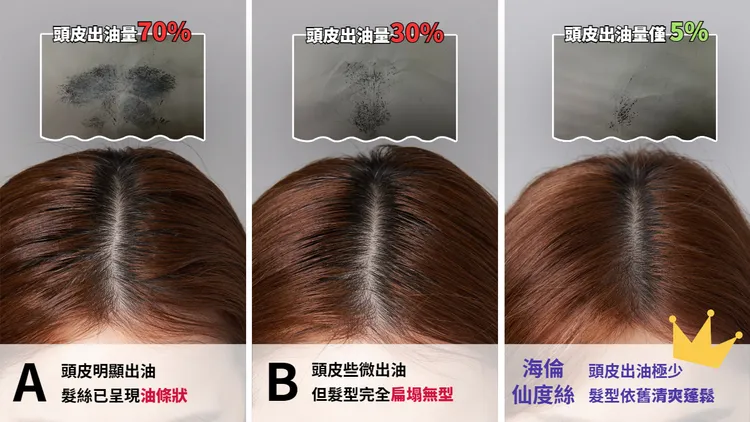 經過48小時後以吸油面紙按壓頭皮，進行比較。